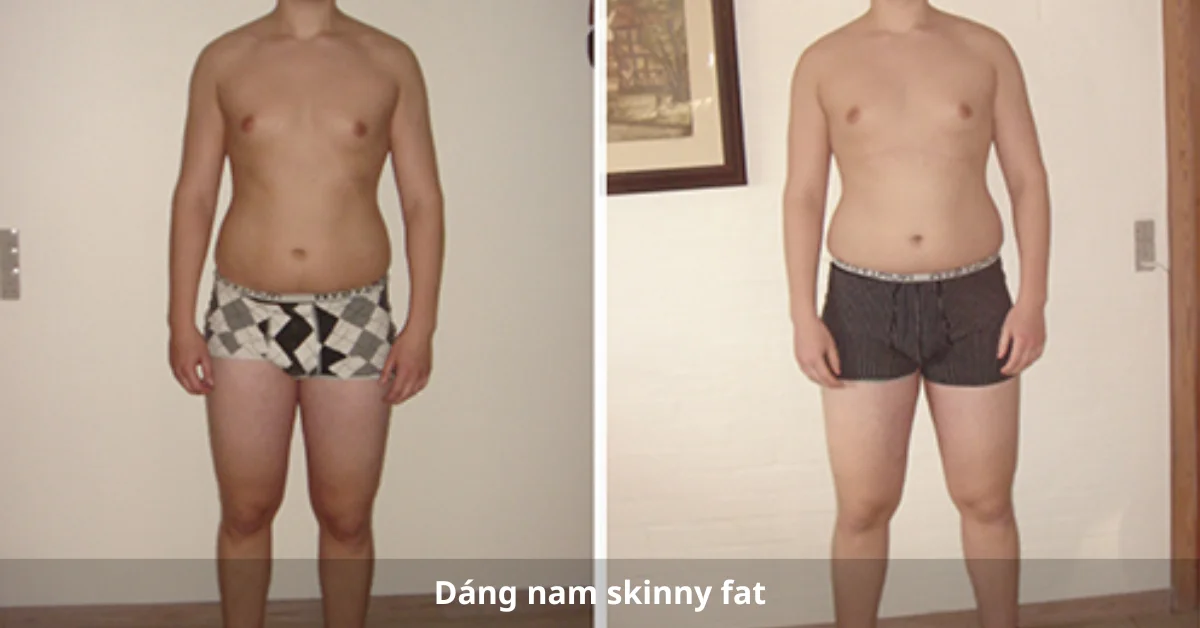 Dáng nam skinny fat